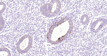 pan CK Ready-To-Use IHC Kit