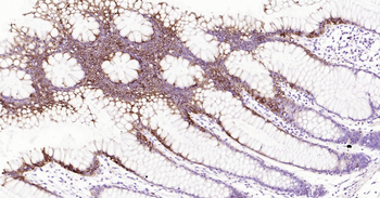 Human CK20 Ready-To-Use IHC Kit