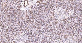 AQP1 Recombinant Rabbit Monoclonal Antibody