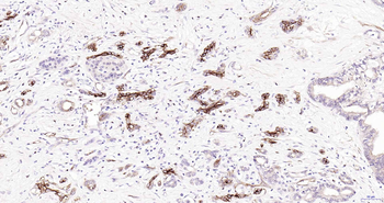 AQP1 Recombinant Rabbit Monoclonal Antibody