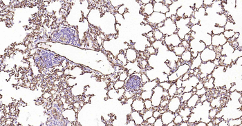 AQP1 Recombinant Rabbit Monoclonal Antibody