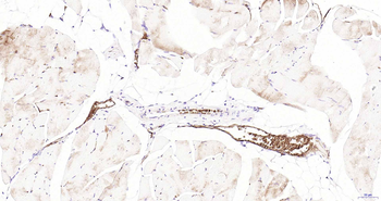 AQP1 Recombinant Rabbit Monoclonal Antibody