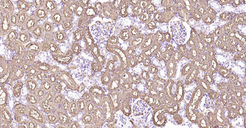 AQP1 Recombinant Rabbit Monoclonal Antibody