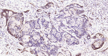 AQP1 Recombinant Rabbit Monoclonal Antibody
