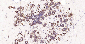 AQP1 Recombinant Rabbit Monoclonal Antibody