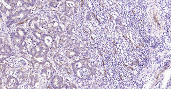 AQP1 Recombinant Rabbit Monoclonal Antibody