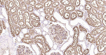 AQP1 Recombinant Rabbit Monoclonal Antibody