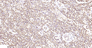 AQP1 Recombinant Rabbit Monoclonal Antibody