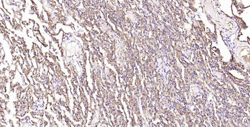 AQP1 Recombinant Rabbit Monoclonal Antibody
