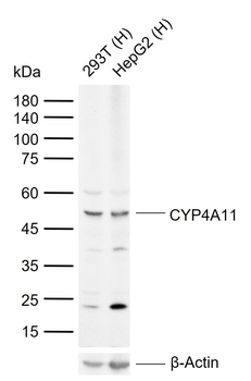 CYP4A11 Rabbit Polyclonal Antibody