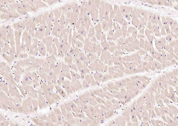 Cardiac Troponin I (cTnI) Mouse Monoclonal Antibody