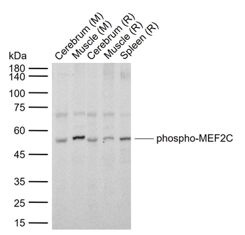 Phospho-MEF2C (Thr300) Rabbit Polyclonal Antibody