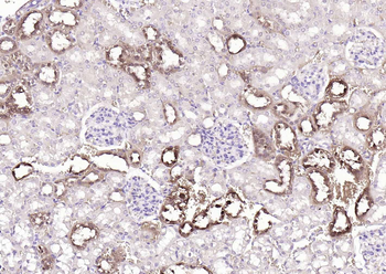 S100A1 Rabbit Polyclonal Antibody