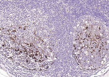 S100A1 Rabbit Polyclonal Antibody