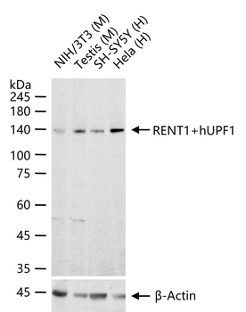 RENT1+hUPF1 Rabbit Polyclonal Antibody