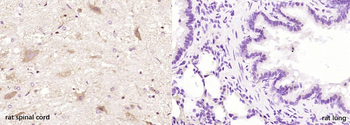 VGLUT2 Rabbit Polyclonal Antibody
