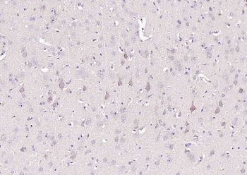 VAT1L Rabbit Polyclonal Antibody