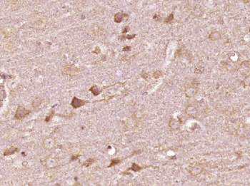 VAT1L Rabbit Polyclonal Antibody