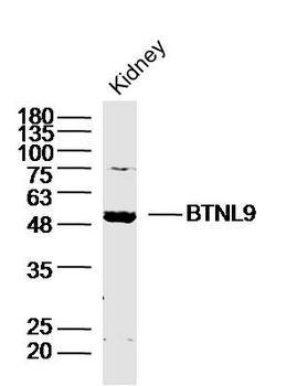 BTNL9 Rabbit Polyclonal Antibody