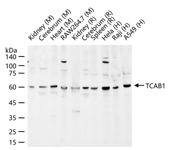 TCAB1 Rabbit Polyclonal Antibody