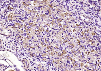 TCAB1 Rabbit Polyclonal Antibody