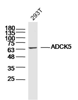 ADCK5 Rabbit Polyclonal Antibody