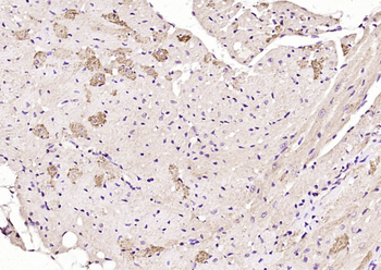 ITGB1BP2 Rabbit Polyclonal Antibody