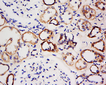 AMPK beta 1/PRKAB1 Rabbit Polyclonal Antibody