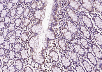 AMPK beta 1/PRKAB1 Rabbit Polyclonal Antibody