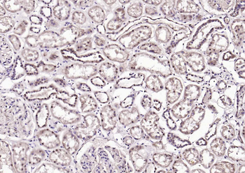 AMPK beta 1/PRKAB1 Rabbit Polyclonal Antibody