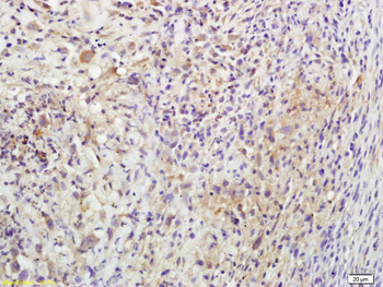 Beta endorphin Rabbit Polyclonal Antibody