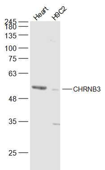 CHRNB3 Rabbit Polyclonal Antibody
