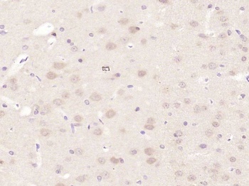 FOXP4 Rabbit Polyclonal Antibody