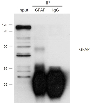 GFAP Rabbit Polyclonal Antibody
