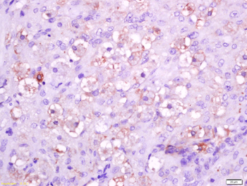 Integrin alpha 5 Rabbit Polyclonal Antibody