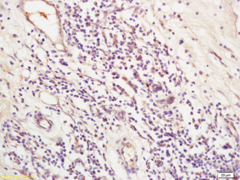 LOXL2 Rabbit Polyclonal Antibody
