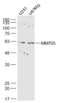 MMP25 Rabbit Polyclonal Antibody