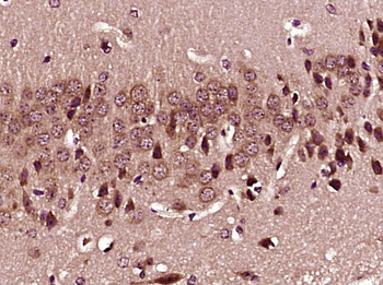 NDUFB5 Rabbit Polyclonal Antibody