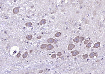 NELL1 Rabbit Polyclonal Antibody
