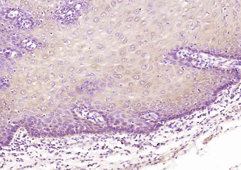NIPA1 Rabbit Polyclonal Antibody