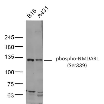 Phospho-NMDAR1 (Ser889) Rabbit Polyclonal Antibody