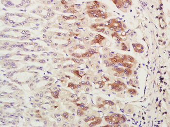 CHCHD2 Rabbit Polyclonal Antibody