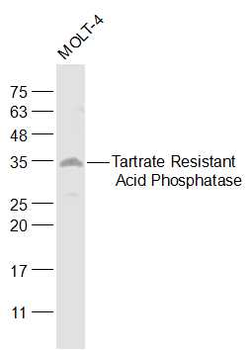 ACP5 Rabbit Polyclonal Antibody