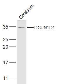 DCUN1D4 Rabbit Polyclonal Antibody