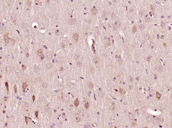 CCDC63 Rabbit Polyclonal Antibody