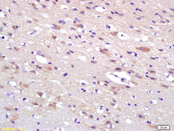 HIP2 Rabbit Polyclonal Antibody