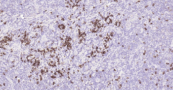 Human CD38 Ready-To-Use IHC Kit