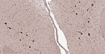 Tyrosine Hydroxylase Ready-To-Use IHC Kit