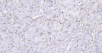 Human CD68 Ready-To-Use IHC Kit