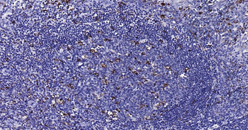 Human CD68 Ready-To-Use IHC Kit